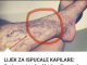 Svatko kod kuće ima lijek za popucale kapilare, ali mnogi ljudi to ne znaju!