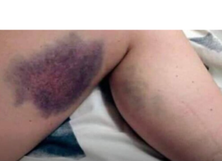 Vitamini koje je zabranjeno uzimati zajedno, ALI NIKO NE ZNA, MOGU BITI OPASNI