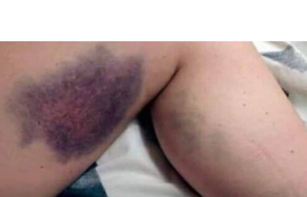 Vitamini koje je zabranjeno uzimati zajedno, ALI NIKO NE ZNA, MOGU BITI OPASNI