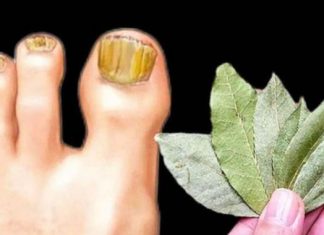 NEVJEROVATNO, ALI ISTINITO: Ova kupka iz kućne radinosti UNIŠTAVA gljivice bolje od skupih tretmana!