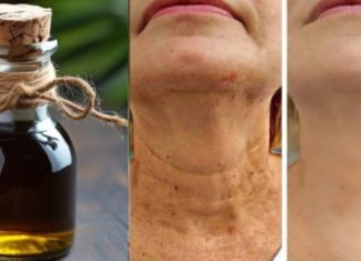 Čarobno ulje protiv starenja, Zaglađuje sve bore na licu snažnije od botoksa Čarobno ulje protiv starenja, Zaglađuje sve bore na licu snažnije od botoksa - featured image