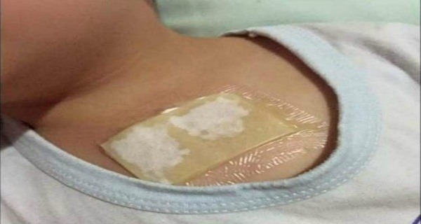 Ovaj kućni lijek rastvara sluz u plućima i oslobađa kašlja. Preko noći uklanja i najteži kašalj, te čisti pluća od nakupljene sluzi! - featured image Ovaj kućni lijek rastvara sluz u plućima i oslobađa kašlja. Preko noći uklanja i najteži kašalj, te čisti pluća od nakupljene sluzi! - featured image