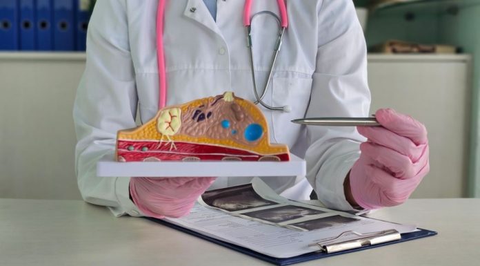 Onkolog nam je otkrio da li je rak dojke nasledna bolest: Iznenadiće vas šta sve utiče na pojavu ove pošasti u organizmu Onkolog nam je otkrio da li je rak dojke nasledna bolest: Iznenadiće vas šta sve utiče na pojavu ove pošasti u organizmu - featured image