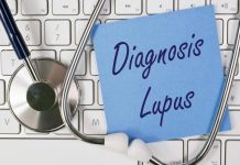 Lupus se često krije iza bezopasnih simptoma: Ovo su rani znaci koje ne smete ignorisati Lupus se često krije iza bezopasnih simptoma: Ovo su rani znaci koje ne smete ignorisati - featured image