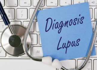 Lupus se često krije iza bezopasnih simptoma: Ovo su rani znaci koje ne smete ignorisati Lupus se često krije iza bezopasnih simptoma: Ovo su rani znaci koje ne smete ignorisati - featured image