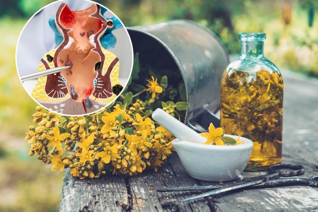 Prirodni melem protiv hemoroida: Čuveni travar otkriva da deluje i kod proširenih vena - featured image