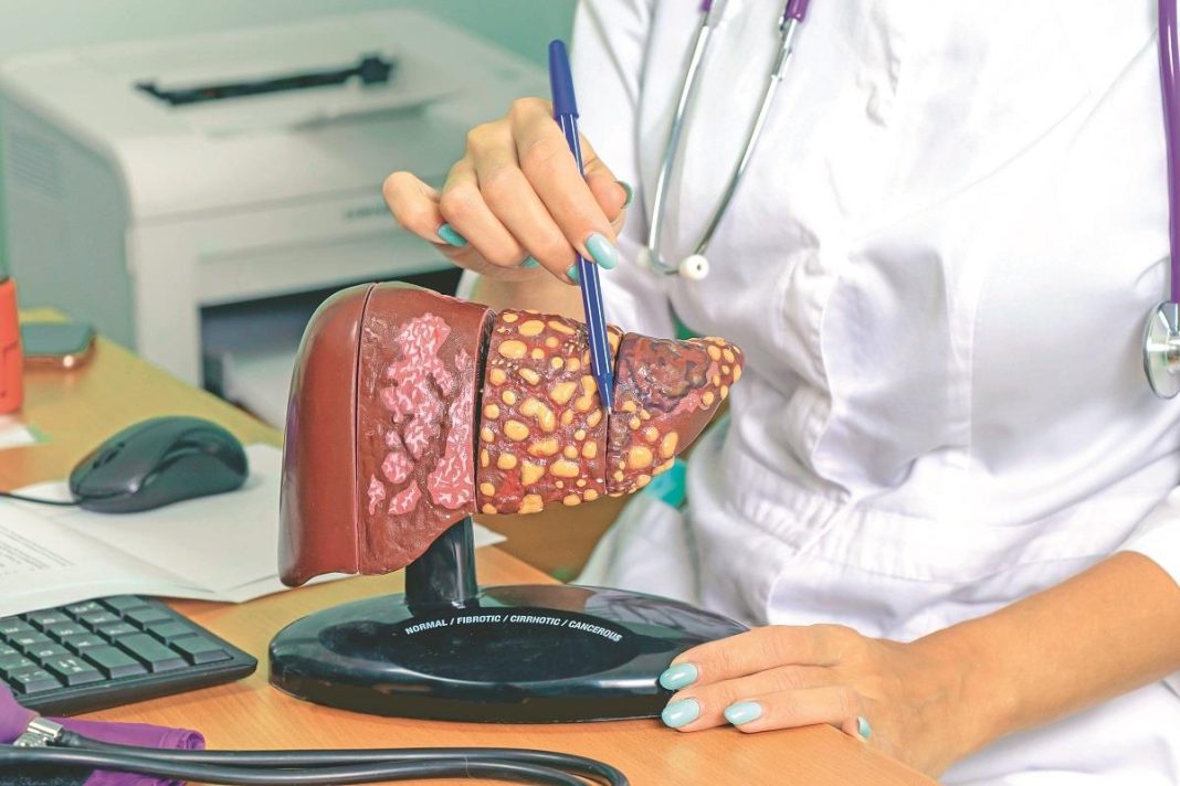 Jelovnik od 7 dana za masnu jetru: 3 obroka za poboljšanje njene funkcije - featured image Jelovnik od 7 dana za masnu jetru: 3 obroka za poboljšanje njene funkcije - featured image