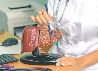 Jelovnik od 7 dana za masnu jetru: 3 obroka za poboljšanje njene funkcije Jelovnik od 7 dana za masnu jetru: 3 obroka za poboljšanje njene funkcije - featured image