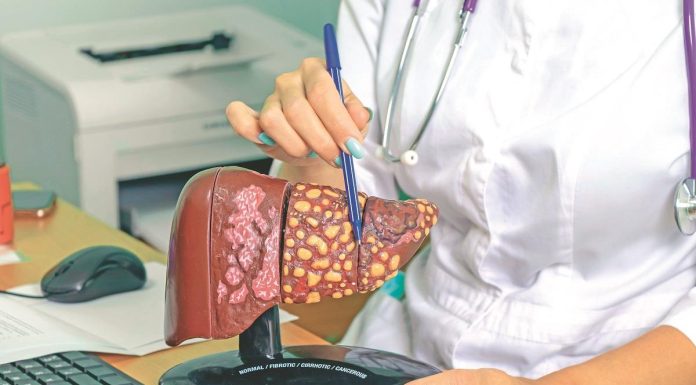 Jelovnik od 7 dana za masnu jetru: 3 obroka za poboljšanje njene funkcije Jelovnik od 7 dana za masnu jetru: 3 obroka za poboljšanje njene funkcije - featured image