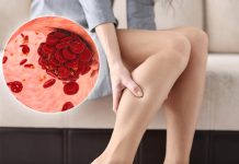 Kako da prepoznate tromb u telu? Ne ignorišite ovih 8 znakova upozorenja Kako da prepoznate tromb u telu? Ne ignorišite ovih 8 znakova upozorenja - featured image