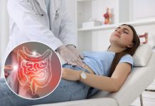 Četiri najčešća znaka upale slepog creva: Ne odlažite pregled, brza dijagnoza spašava život Četiri najčešća znaka upale slepog creva: Ne odlažite pregled, brza dijagnoza spašava život - featured image