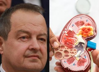 Ivica Dačić ne boluje samo od upale pluća, ovu bolest je ignorisao godinama, a tiho razara sve organe: Srbi je zanemaruju dok stanje ne postane opasno Ivica Dačić ne boluje samo od upale pluća, ovu bolest je ignorisao godinama, a tiho razara sve organe: Srbi je zanemaruju dok stanje ne postane opasno - featured image