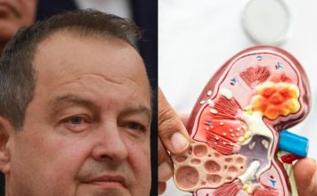 Ivica Dačić ne boluje samo od upale pluća, ovu bolest je ignorisao godinama, a tiho razara sve organe: Srbi je zanemaruju dok stanje ne postane opasno Ivica Dačić ne boluje samo od upale pluća, ovu bolest je ignorisao godinama, a tiho razara sve organe: Srbi je zanemaruju dok stanje ne postane opasno - featured image