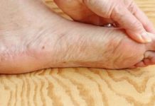 7 znakova da se tijelo već duže vrijeme bori s VISOKIM ŠEĆEROM U KRVI: Prvo ćete to primijetiti na očima i nogama! 7 znakova da se tijelo već duže vrijeme bori s VISOKIM ŠEĆEROM U KRVI: Prvo ćete to primijetiti na očima i nogama! - featured image