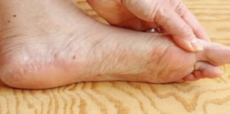 7 znakova da se tijelo već duže vrijeme bori s VISOKIM ŠEĆEROM U KRVI: Prvo ćete to primijetiti na očima i nogama! 7 znakova da se tijelo već duže vrijeme bori s VISOKIM ŠEĆEROM U KRVI: Prvo ćete to primijetiti na očima i nogama! - featured image