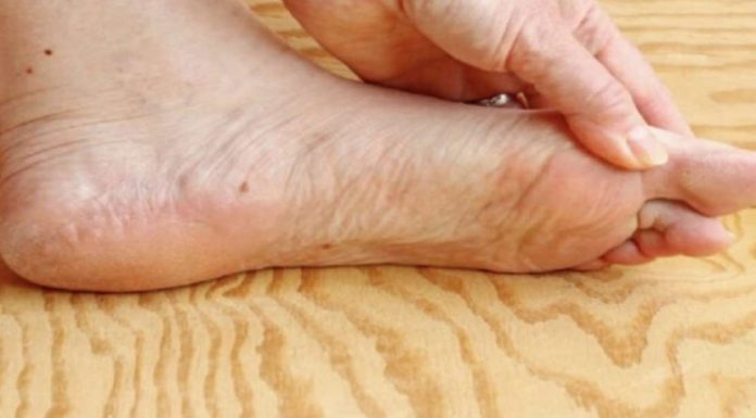 7 znakova da se tijelo već duže vrijeme bori s VISOKIM ŠEĆEROM U KRVI: Prvo ćete to primijetiti na očima i nogama! 7 znakova da se tijelo već duže vrijeme bori s VISOKIM ŠEĆEROM U KRVI: Prvo ćete to primijetiti na očima i nogama! - featured image