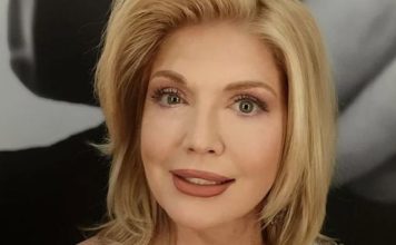 Počastila se Suzana faceliftingom