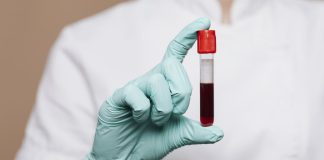 Ova krvna grupa nosi OGROMAN rizik od dijabetesa – mnogi to saznaju prekasno