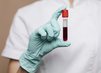 Ova krvna grupa nosi OGROMAN rizik od dijabetesa – mnogi to saznaju prekasno