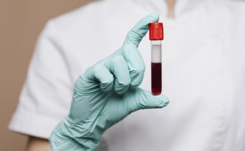 Ova krvna grupa nosi OGROMAN rizik od dijabetesa – mnogi to saznaju prekasno