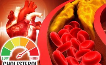 Šest znakova da imate visok holesterol: Ako osećate bol u vratu odmah se javite lekaru