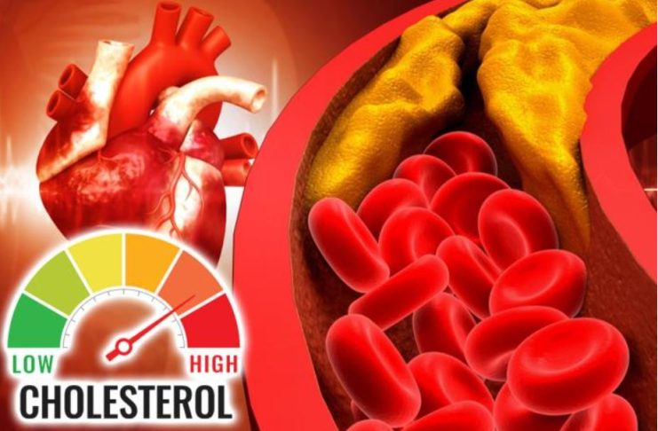 Šest znakova da imate visok holesterol: Ako osećate bol u vratu odmah se javite lekaru