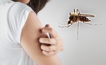 Zašto komarci uvek ujedaju iste ljude? Razlog nije krvna grupa, već nešto drugo Zašto komarci uvek ujedaju iste ljude? Razlog nije krvna grupa, već nešto drugo - featured image