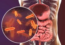 Pojedite ovu voćku svaki dan i creva će raditi kao sat: Tvrdi doktorka Pojedite ovu voćku svaki dan i creva će raditi kao sat: Tvrdi doktorka - featured image